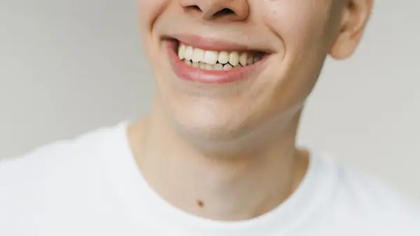 Segredos para conquistar um sorriso mais branco em Fortaleza